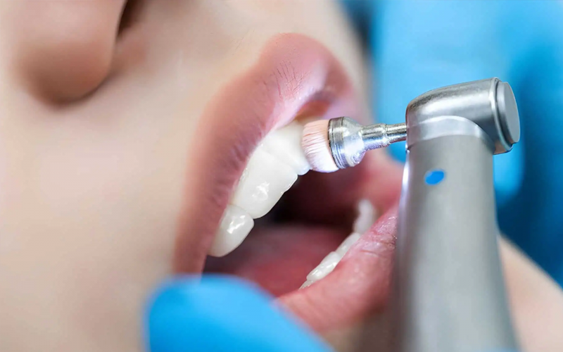 Why Dental Cleaning Matters