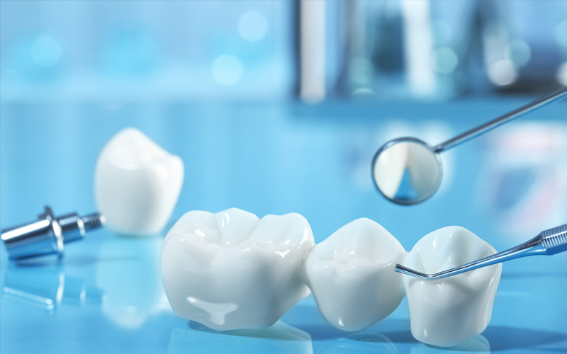 Dental Implant Candidate