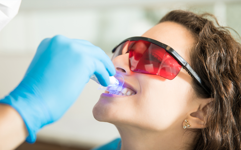Teeth Whitening Seattle