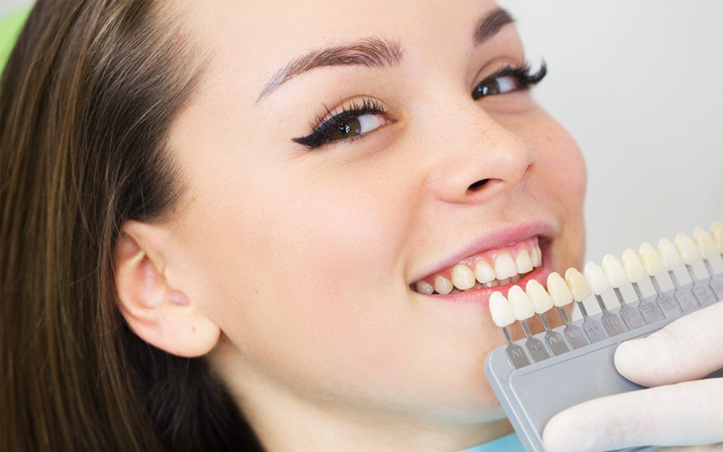 Professional Whitening