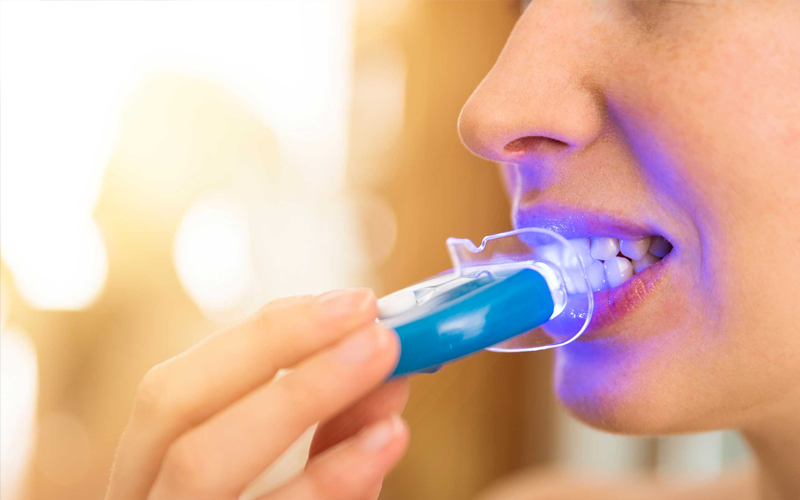 Whitening Results
