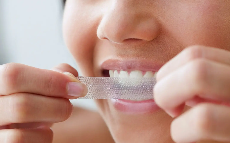 Whitening Results